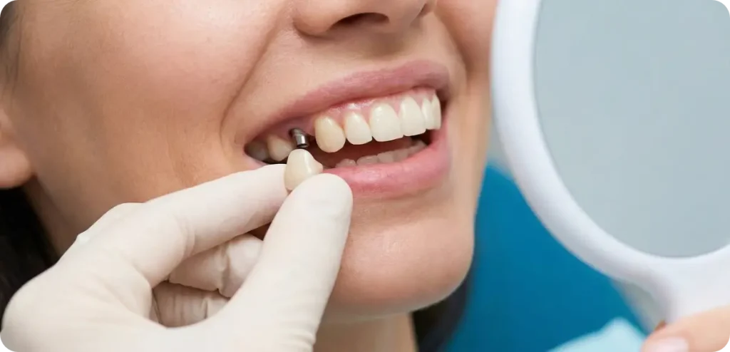 This is a before-and-after comparison of the treatment.