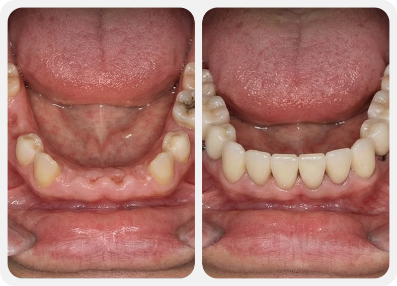 This is a before-and-after comparison of the treatment.