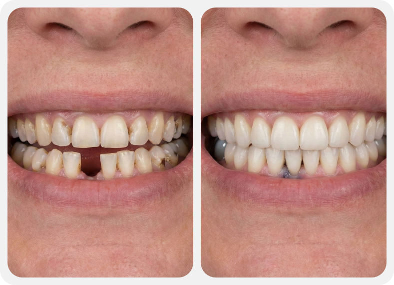 This is a before-and-after comparison of the treatment.